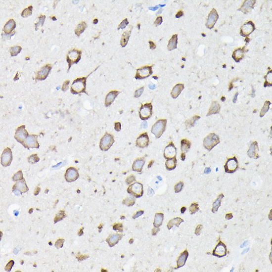 a03304 eef1a2 primary antiboties ihc testing 2