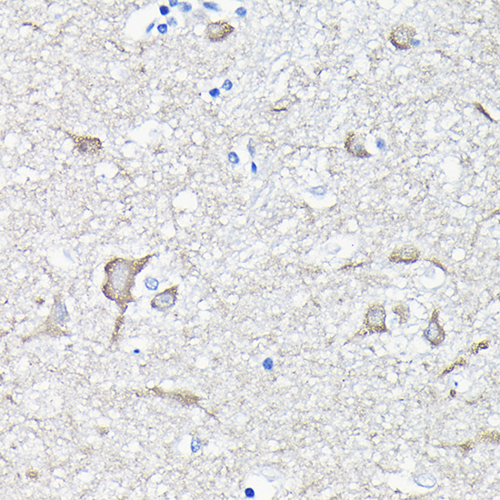 a03304 eef1a2 primary antiboties ihc testing 3