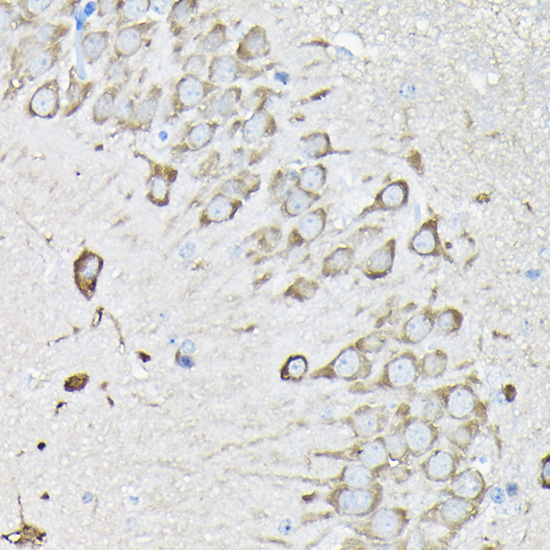 a03304 eef1a2 primary antiboties ihc testing 4