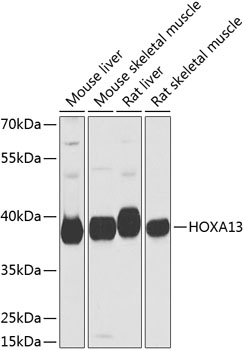 Western blot analysis of extracts of various cell lines, using HOXA13 antibody  at 1:1000 dilution