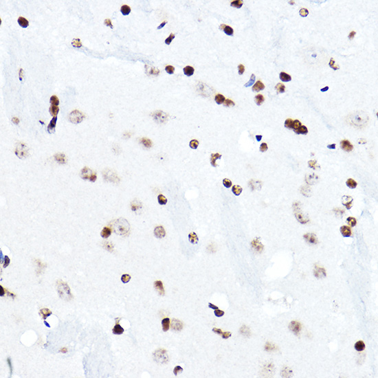 a03307 1 elf5 primary antiboties ihc testing 3