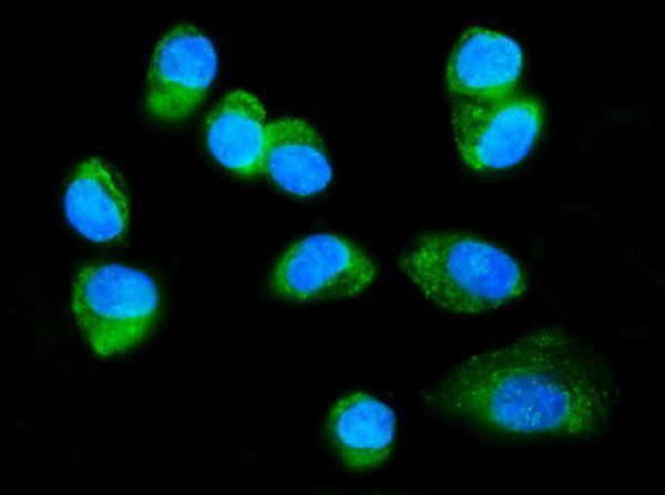 a03308 2 fxr1 primary antibodies if testing 6