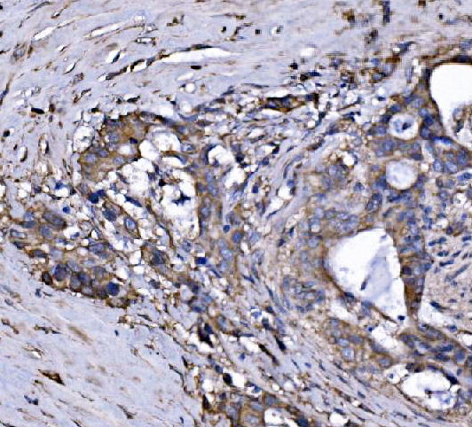  IHC analysis of FXR1 using anti-FXR1 antibody (A03308-2)