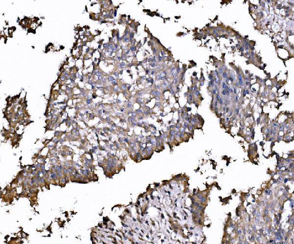  IHC analysis of FXR1 using anti-FXR1 antibody (A03308-2)