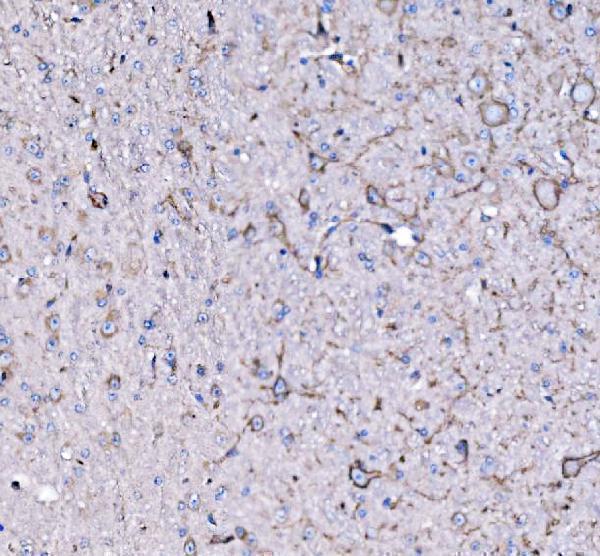 a03308 2 fxr1 primary antibodies ihc testing 4