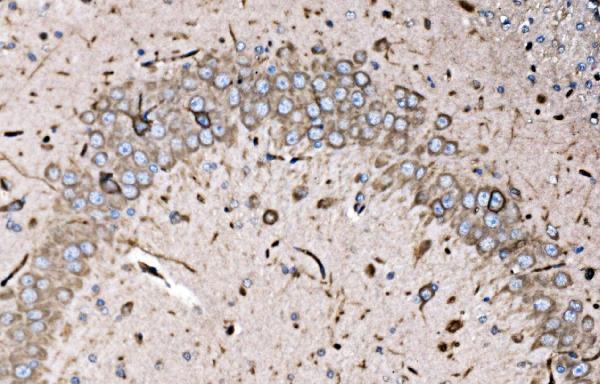 a03308 2 fxr1 primary antibodies ihc testing 5
