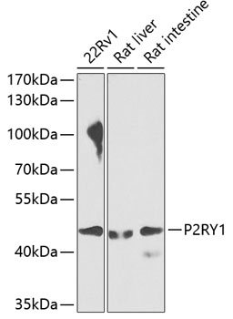 a03309 p2ry1 primary antiboties wb testing 1