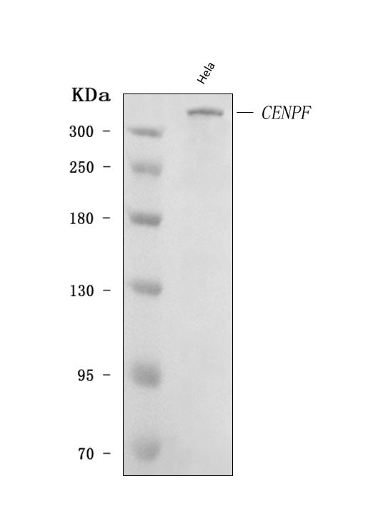  Western blot analysis of CENPF using anti-CENPF antibody (A03311-1)