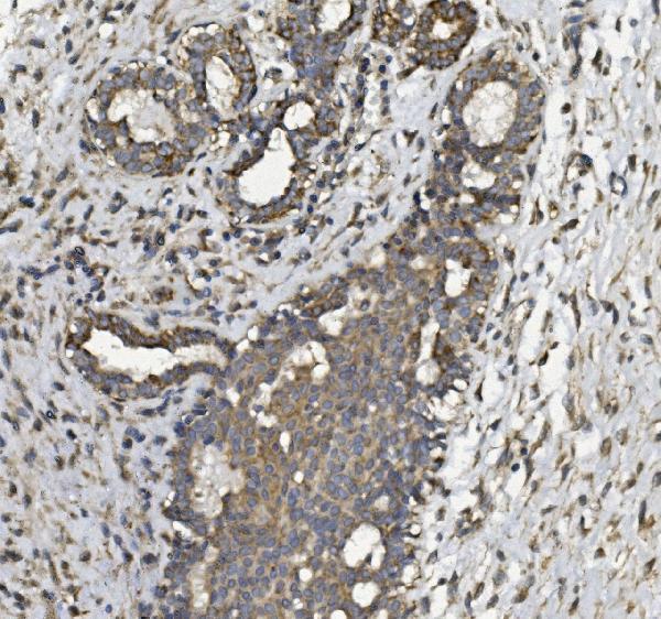 a03315 3 phb2 primary antibodies ihc testing 3