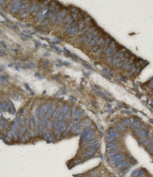 a03315 3 phb2 primary antibodies ihc testing 4