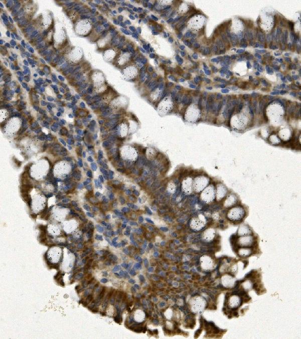 a03315 3 phb2 primary antibodies ihc testing 5