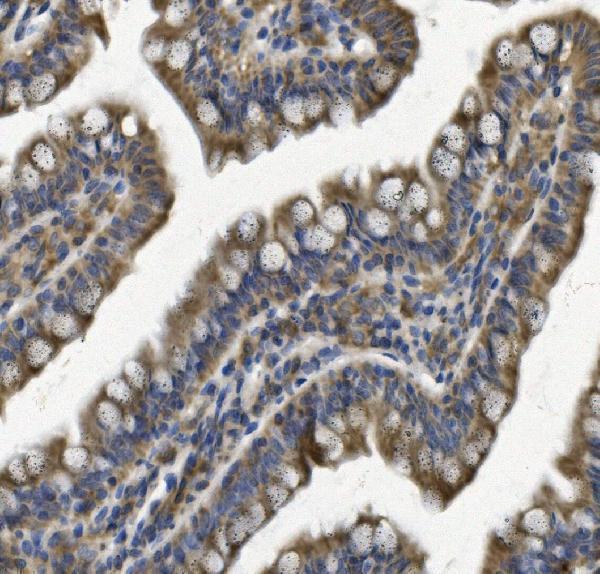 a03315 3 phb2 primary antibodies ihc testing 6