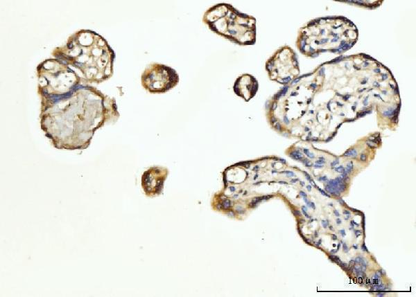 a03316 2 fgf3 primary antibodies ihc testing 1