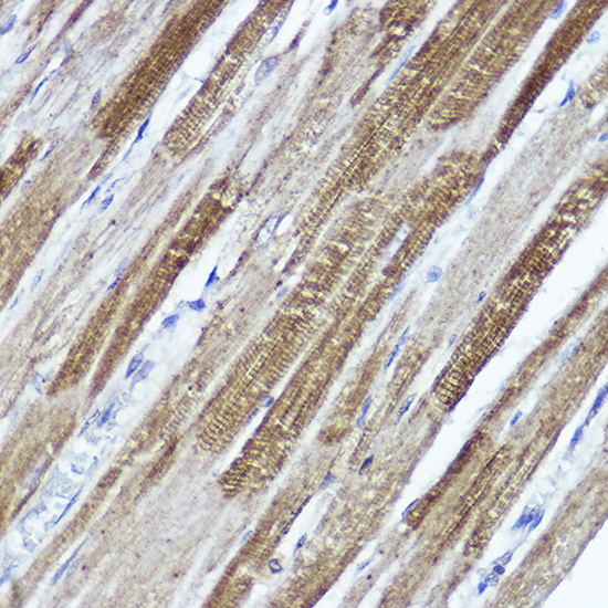 a03317 1 kcnd3 primary antiboties ihc testing 2