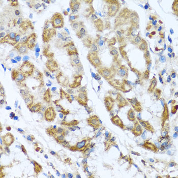 Immunohistochemistry of paraffin-embedded human stomach using ANTXR2 antibody  at dilution of 1:100 