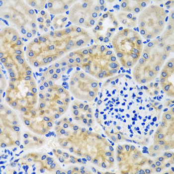 Immunohistochemistry of paraffin-embedded mouse kidney using ANTXR2 antibody  at dilution of 1:100 