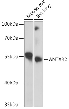 Western blot analysis of extracts of various cell lines, using ANTXR2 Rabbit pAb  at 1:1000 dilution