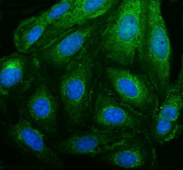IF analysis of PEX14 using anti-PEX14 antibody (A03327-3)