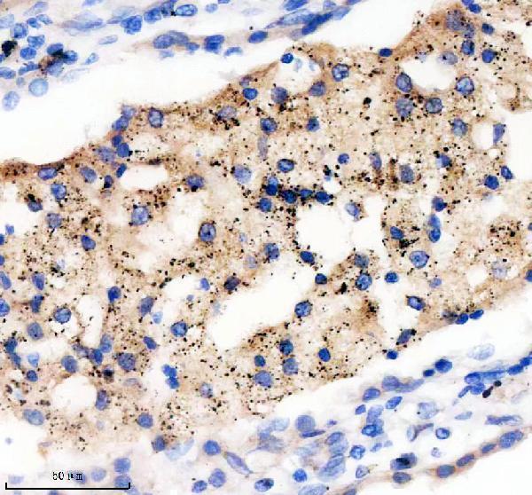 IHC analysis of PEX14 using anti-PEX14 antibody (A03327-3)