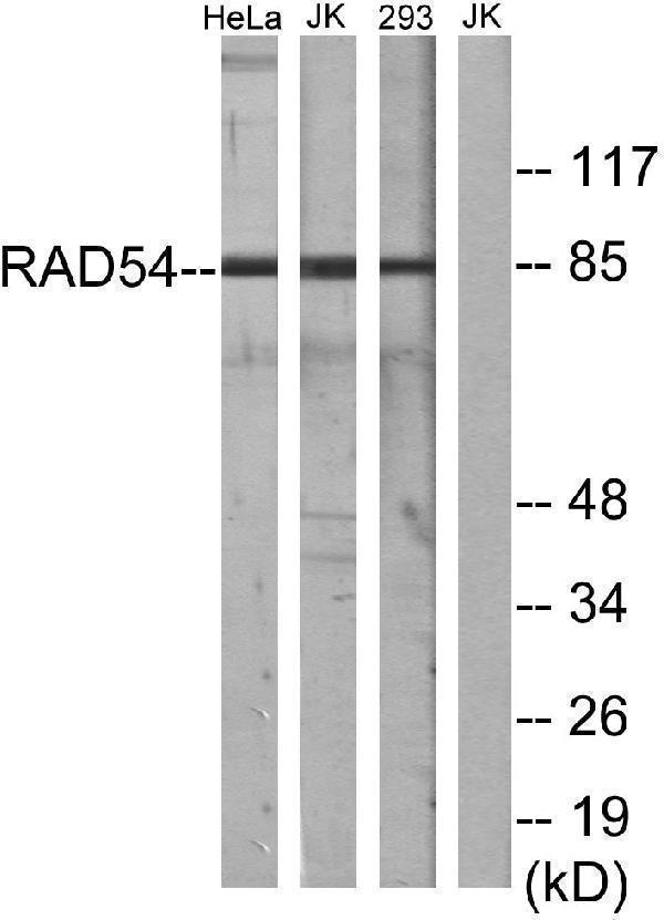 Western blot analysis of lysates from HeLa cells, Jurkat cells, and 293 cells, using RAD54 Antibody