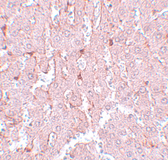 Immunohistochemistry of LXR-A in rat liver tissue with LXR-A antibody at 5 μg/mL
