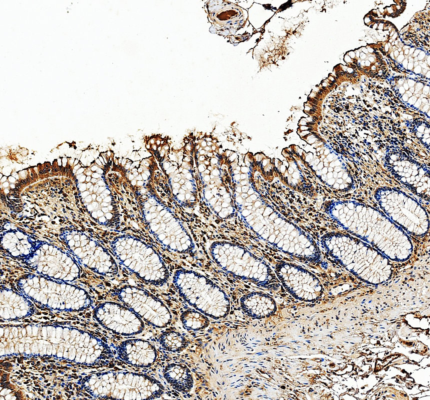 a03335 2 slc26a3 primary antibodies ihc testing 1