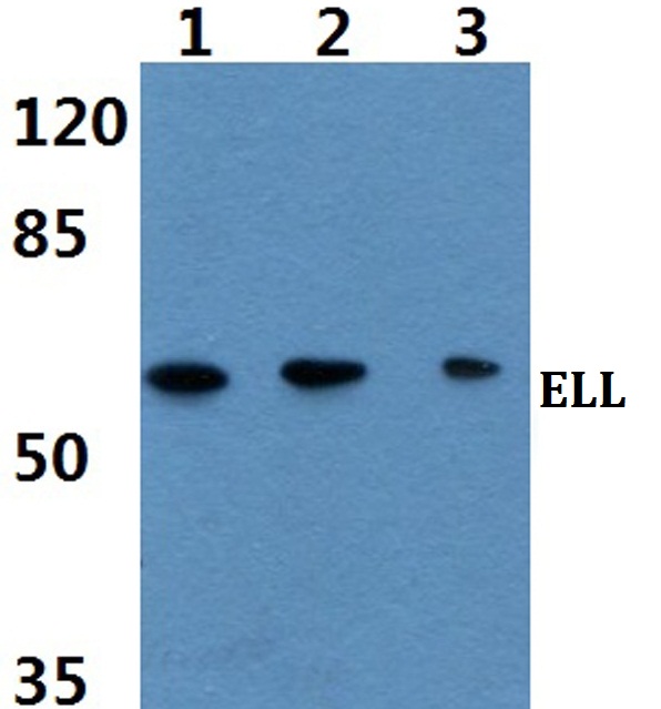 Western blot (WB) analysis of ELL (D125) polyclonal antibody at 1:500 dilution
Lane1:Hela cell lysate
Lane2:sp2/0 cell lysate
Lane3:H9C2 cell lysate