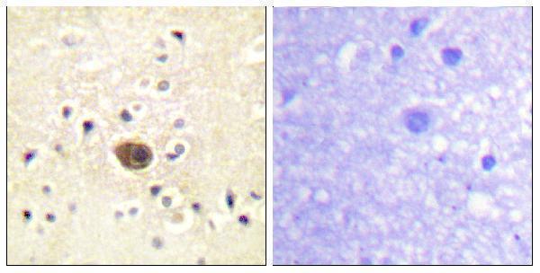 a03338 1 rasgrf1 primary antibodies ihc testing 1
