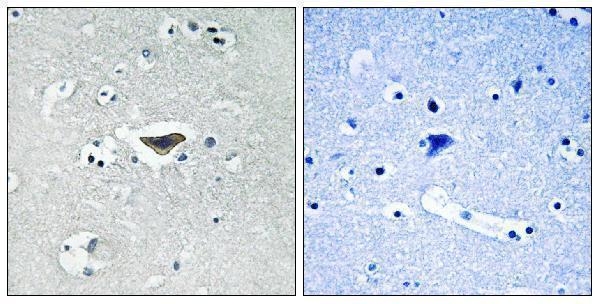 a03338s916 rasgrf1 primary antibodies ihc testing 2