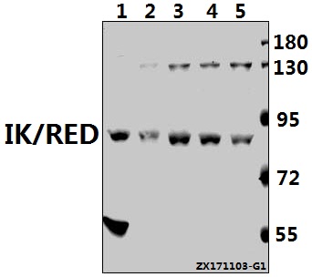 Western blot (WB) analysis of IK/RED (P555) pAb at 1:500 dilution
Lane1:CT26 whole cell lysate(40ug)
Lane2:The Brain tissue lysate of Rat(40ug)
Lane3:Hela whole cell lysate(40ug)
Lane4:MCF-7 whole cell lysate(40ug)
Lane5:H1792 whole cell lysate(40ug)