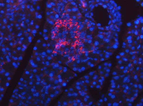 a03343 2 sel1l primary antibodies if testing 5