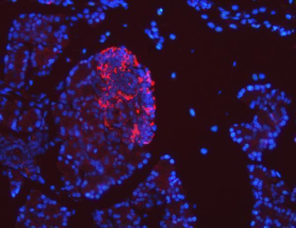 a03343 2 sel1l primary antibodies if testing 6