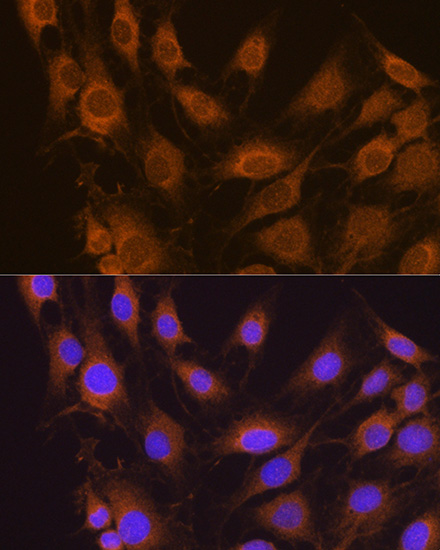 a03343 sel1l primary antiboties if testing 2