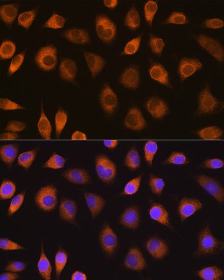 a03343 sel1l primary antiboties if testing 3