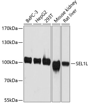 a03343 sel1l primary antiboties wb testing 1