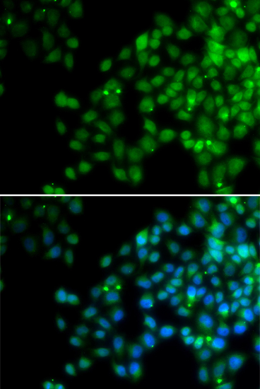 a03346 epc1 primary antiboties if testing 2