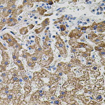Immunohistochemistry of paraffin-embedded human liver damage using NTF3 antibody  