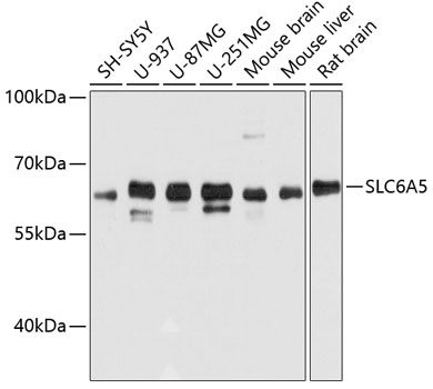 a03349 slc6a5 primary antiboties wb testing 1