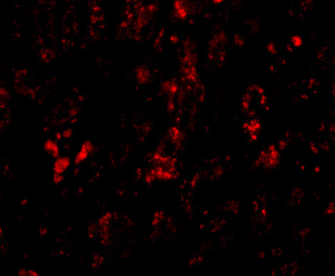 Immunofluorescence of AFAP1L2 in human liver tissue with AFAP1L antibody at 20 μg/mL