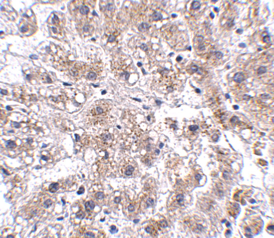 Immunohistochemistry of AFAP1L2 in human liver tissue with AFAP1L2 antibody at 2