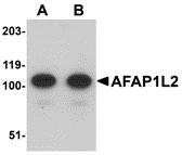 Western blot analysis of AFAP1L2 in mouse liver tissue lysate with AFAP1L2 antibody at (A) 1 and (B) 2 μg/mL