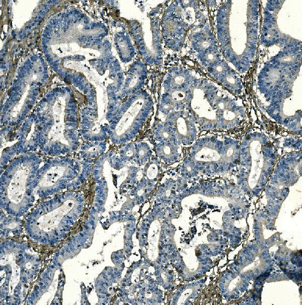 a03352 1 f2r primary antibodies ihc testing 3
