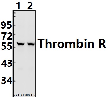 Western blot (WB) analysis of Thrombin R (S42) pAb at 1:500 dilution
Lane1:HepG2 whole cell lysate(40ug)
Lane2:AML-12 whole cell lysate(40ug)