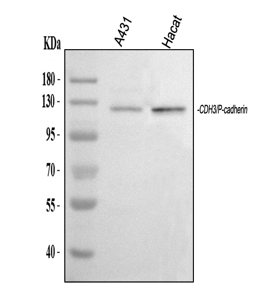 a03353 1 cdh3 primary antibodies wb testing 1