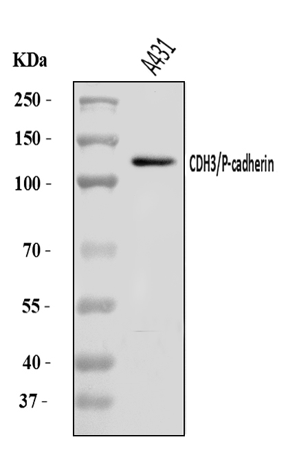 Western blot analysis of P Cadherin/CDH3 using anti-P Cadherin/CDH3 antibody (A03353-2)