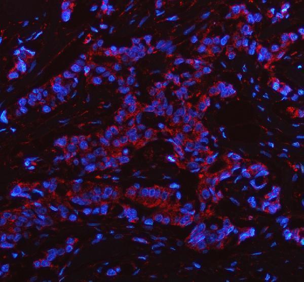 a03355 1 phgdh primary antibodies if testing 1