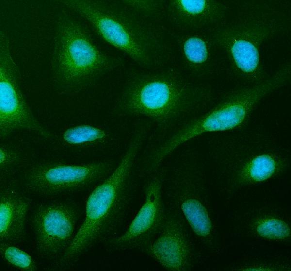 a03355 1 phgdh primary antibodies if testing 3