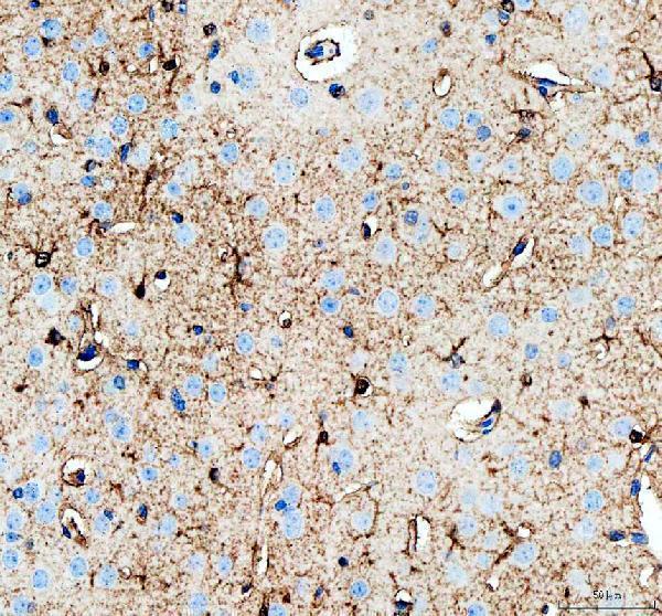 IHC analysis of PHGDH using anti-PHGDH antibody (A03355-1)