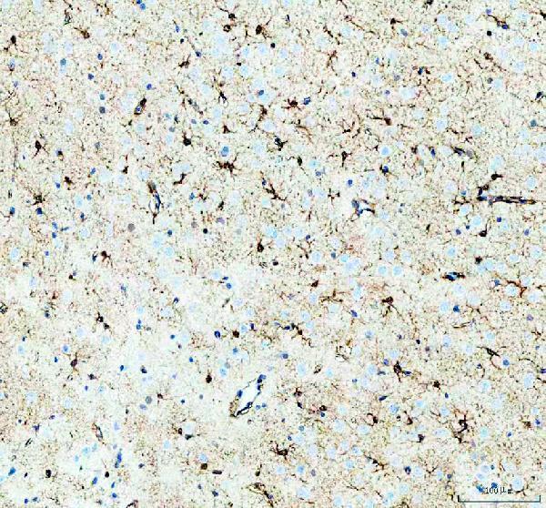 a03355 1 phgdh primary antibodies ihc testing 3