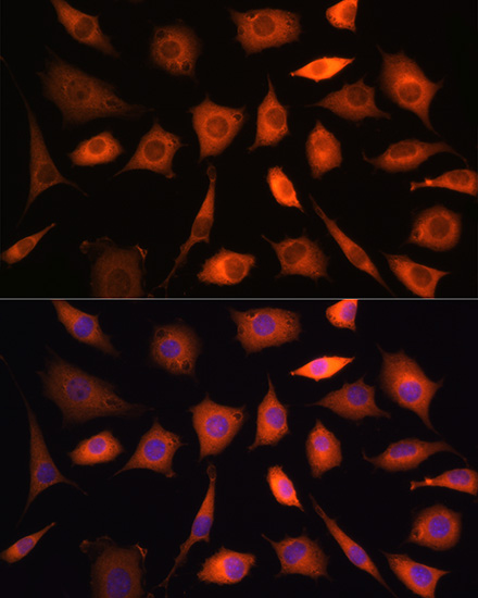 Immunofluorescence analysis of H9C2 cells using PHGDH antibody  at dilution of 1:100